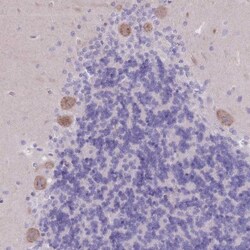 PIGM Antibody, Novus Biologicals:Antibodies:Primary Antibodies